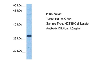 CPA4 Rabbit Polyclonal Antibody