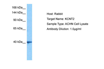 KCNT2 Rabbit Polyclonal Antibody
