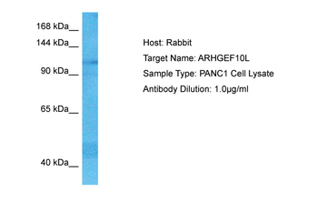 ARHGEF10L Rabbit Polyclonal Antibody