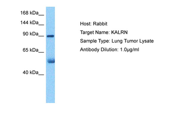 KALRN Rabbit Polyclonal Antibody