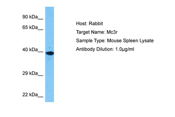 MC3R Rabbit Polyclonal Antibody
