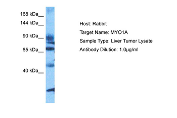 MYO1A Rabbit Polyclonal Antibody