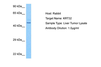KRT32 Rabbit Polyclonal Antibody