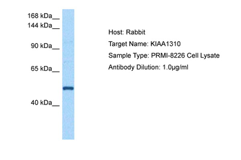 KANSL3 Rabbit Polyclonal Antibody