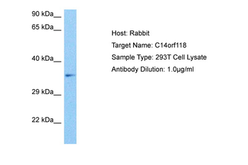 GPATCH2L Rabbit Polyclonal Antibody
