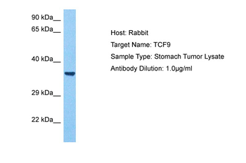 GCFC2 Rabbit Polyclonal Antibody