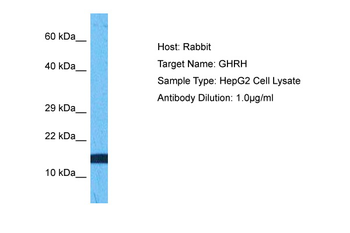 GHRH Rabbit Polyclonal Antibody