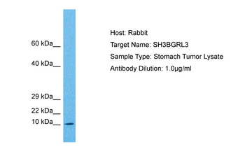 SH3BGRL3 Rabbit Polyclonal Antibody