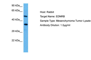 EDNRB Rabbit Polyclonal Antibody