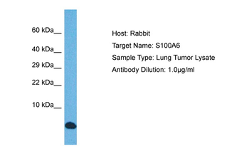 S100A6 Rabbit Polyclonal Antibody