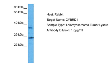 CYBRD1 Rabbit Polyclonal Antibody