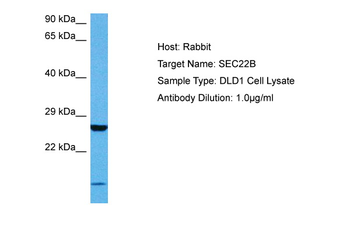 SEC22B Rabbit Polyclonal Antibody