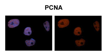PCNA Rabbit Polyclonal Antibody