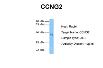 CCNG2 Rabbit Polyclonal Antibody
