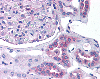 CCL2 Rabbit Polyclonal Antibody