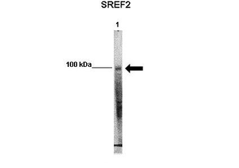 SREBF2 Rabbit Polyclonal Antibody