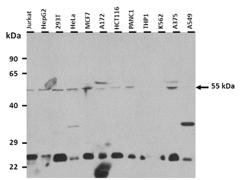 HTR3A Rabbit Polyclonal Antibody