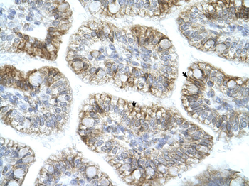 APBA1 Rabbit Polyclonal Antibody