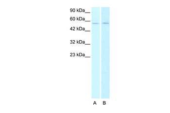 CHRNA2 Rabbit Polyclonal Antibody