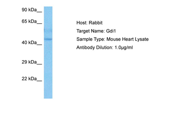 GDI1 Rabbit Polyclonal Antibody