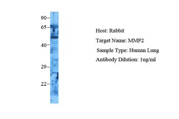 MMP2 Rabbit Polyclonal Antibody