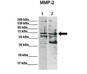 MMP2 Rabbit Polyclonal Antibody