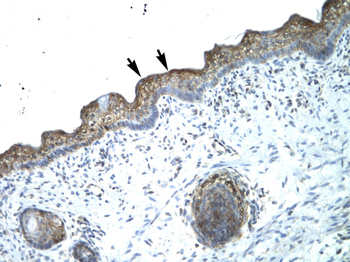 MYBL2 Rabbit Polyclonal Antibody