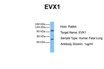 EVX1 Rabbit Polyclonal Antibody