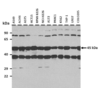 PAX2 Rabbit Polyclonal Antibody