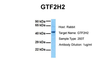 GTF2H2 Rabbit Polyclonal Antibody