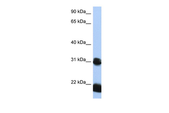 OTX1 Rabbit Polyclonal Antibody