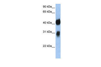 OTX1 Rabbit Polyclonal Antibody