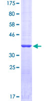 SFTPA1 (Human) Recombinant Protein (P01)
