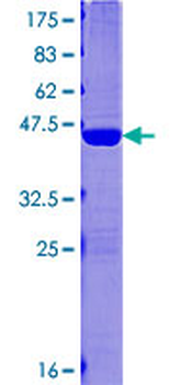MAP1LC3C (Human) Recombinant Protein (P01)