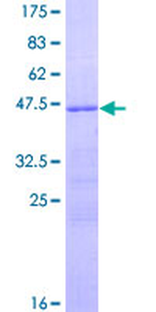 RSPO2 (Human) Recombinant Protein (P01)
