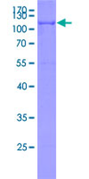 PCSK9 (Human) Recombinant Protein (P01)
