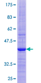 FNDC5 (Human) Recombinant Protein (P01)