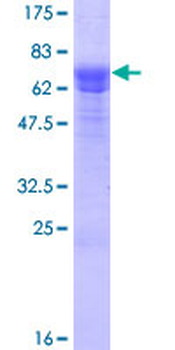 SESN3 (Human) Recombinant Protein (P01)
