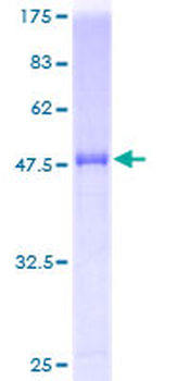 IL1F7 (Human) Recombinant Protein (P01)