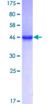 RNF11 (Human) Recombinant Protein (P01)