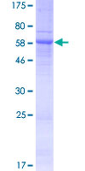 SH3YL1 (Human) Recombinant Protein (P01)