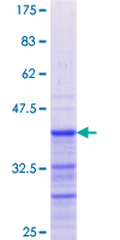 GREM1 (Human) Recombinant Protein (Q02)