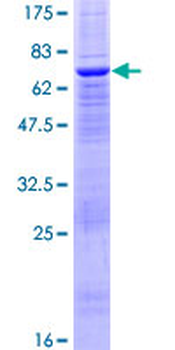 PTPN18 (Human) Recombinant Protein (P01)