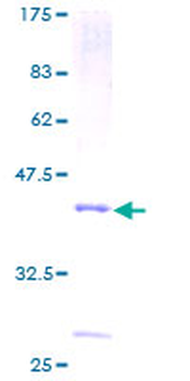PLA2G2D (Human) Recombinant Protein (P01)