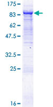 VPS33B (Human) Recombinant Protein (P01)