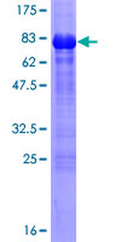 WWTR1 (Human) Recombinant Protein (P01)