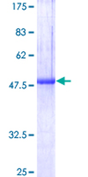 SOSTDC1 (Human) Recombinant Protein (P01)