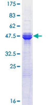 ASF1A (Human) Recombinant Protein (P01)