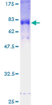FBXL2 (Human) Recombinant Protein (P01)