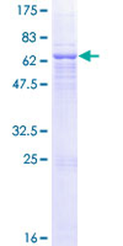 QPCT (Human) Recombinant Protein (P01)
